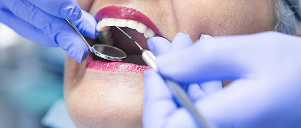 Best Emergency Root Canal Treatment in Covington, OH